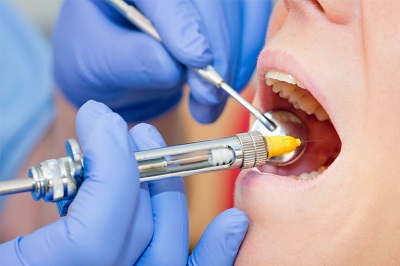 11 правил роботи стоматологій під час карантину від МОЗ